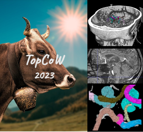 menze_group's tweet photo. TopCoW challenge happening at MICCAI 2023! First public challenge on Circle of Willis (CoW) vessel segmentation on two common angiographic imaging modalities MRA and CTA!

We look forward to your registration at https://t.co/IMYISxPViV Submission is until mid-late Sep. 🐮 https://t.co/FiustKInVk