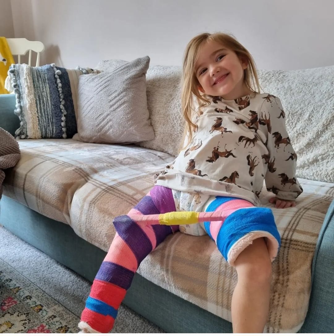 STEPS_Charity's tweet photo. 🌟Another super, resilient, forever smiling and talented #DDHwarrior, Amelia! Your family are so proud, and, so are #TeamSteps 🌟 https://t.co/QcvyrEnTxV
