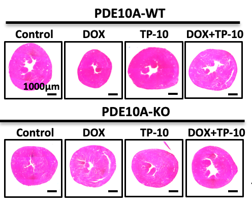 CircRes's tweet photo. Chen et al found that #PDE10A contributes to #DOX induced cardiotoxicity by antagonizing #cGMP/#PKG signaling & CM #atrophy by potentiating #FoxO3 signaling. Learn more about targeting PDE10A to combat cardiac #chemotoxicity at https://t.co/ud0MmxNcVG
@coolcs1115 https://t.co/wYFYjEB3sD