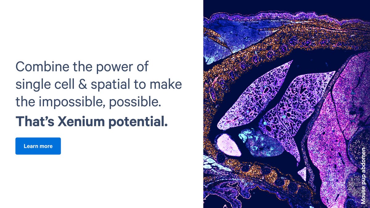 10xGenomics's tweet photo. Precision, meet power. Explore how Xenium #InSitu gives you the best of both by building on a decade of #singlecell &amp; #spatial advances, enabling you to unlock biology at subcellular resolution.
https://t.co/z5gLmBD6Xe https://t.co/QgpBpB8AFJ
