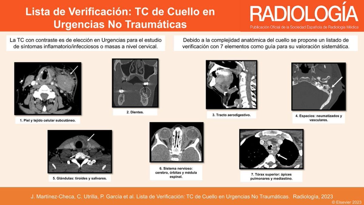 RevistaRADIOLO2's tweet photo. ¿Conoces todas las urgencias cervicales no traumáticas? ¿Qué estructuras debes repasar? ¿Cómo debe ser tu informe? Repásalo en este magnífico artículo! https://t.co/LQ1ns6uWhf…
@SERAUWeb
@SENR_org https://t.co/9Dpd9I94qq