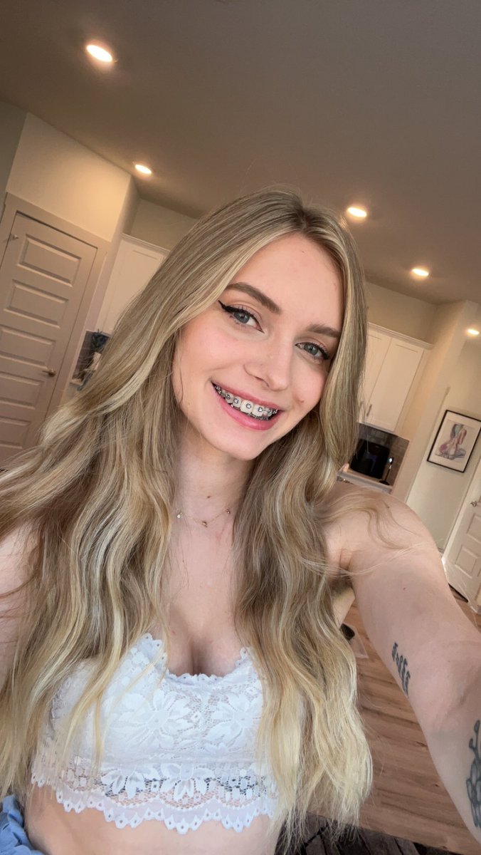 Sarina Desiree on Twitter: "as awkward as braces look sometimes, they