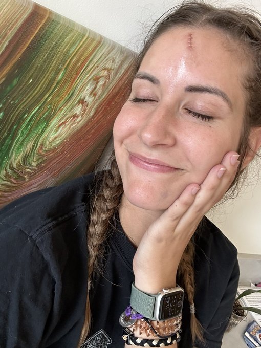 Plz excuse my puffy face. I have been crying a lot.   I got into a really scary car accident yesterday