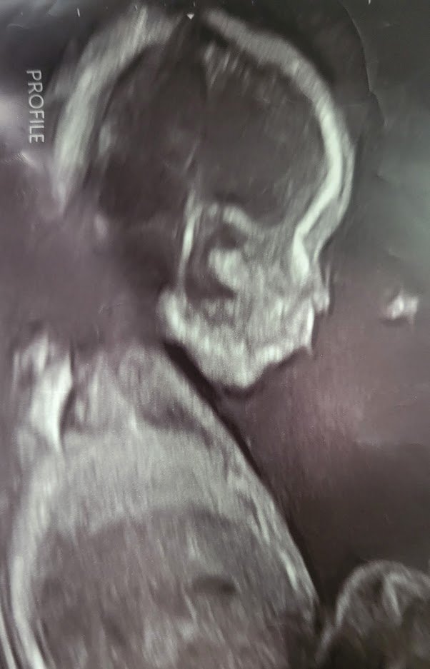 SpappyGram's tweet photo. Been a year since I've tweeted, but I did a thing.

Its a boy, and Paige is due in November!🔵👶🍼 https://t.co/qJzo9SQCtY