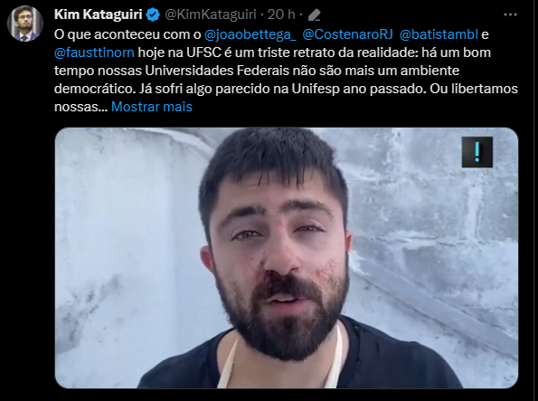 planet_liberal's tweet photo. A cada momento que passa esse guerreiro se machuca mais!

Pray for MBL 🙏 https://t.co/F8AHlS18BO