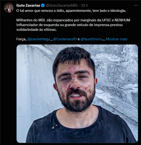 planet_liberal's tweet photo. A cada momento que passa esse guerreiro se machuca mais!

Pray for MBL 🙏 https://t.co/F8AHlS18BO