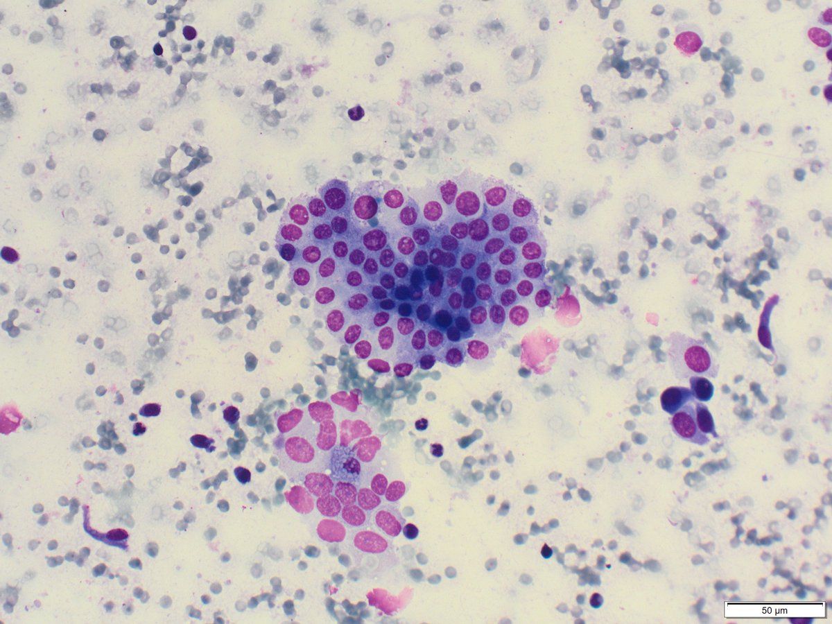 Nice classic pattern in a lung for this #FNAFriday.