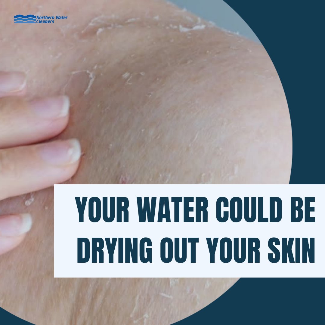 NWCsk's tweet image. Is your skin feeling dry and parched?

Have your water tested by a Northern Water Cleaner expert! 

Our advanced filtration system removes harsh minerals and chemicals, delivering softer, gentler water that’s clean and healthy!

#skincare #watercleaner #cleaningsolution