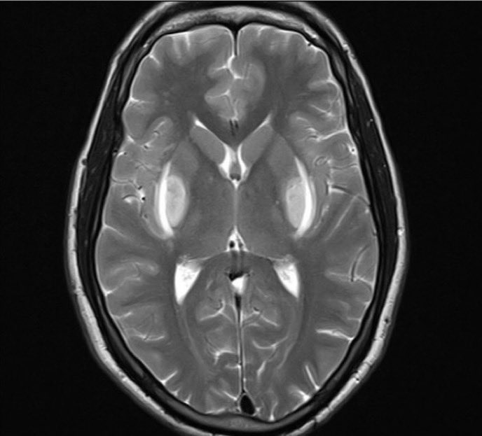 Journal of Brown Hospital Medicine tweet media