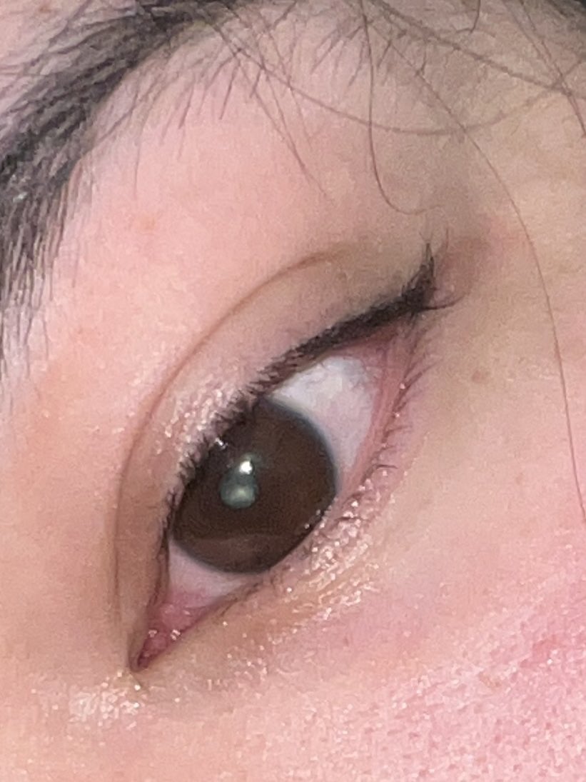 omnichibb's tweet photo. I’ve officially begun to lose my left eye’s vision I am legally blind and it’s only about to get worse—i won’t be able to use my phone soon. I’m alone as we know I got left behind for a vacation in the middle of my blindness. I need help before I officially lose sight Please help https://t.co/lAdB2Mv6rX