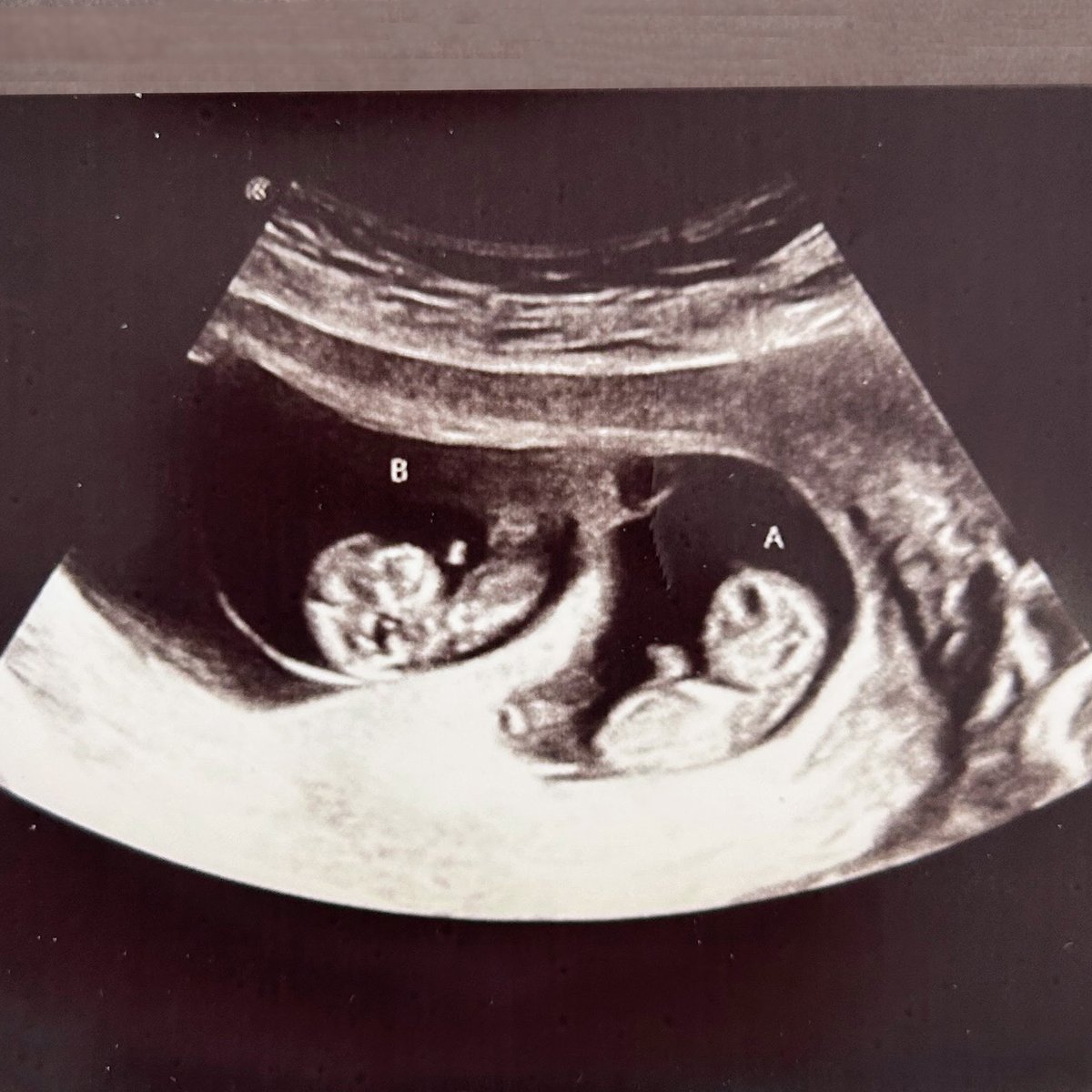 Aaron Francis tweet media