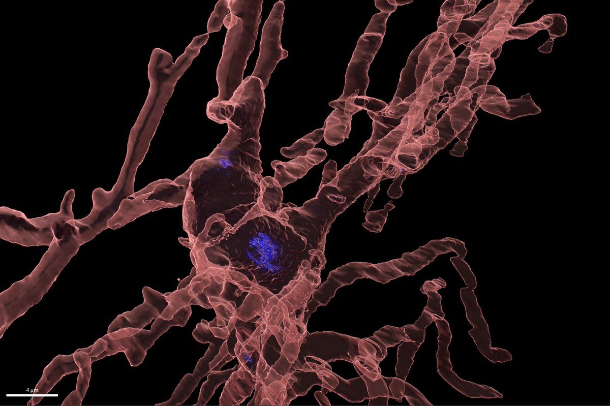 Juan Pablo Taborda-Bejarano (@juanptaborda6) on Twitter photo Some hungry microglia got fed today!
#fluorescentfriday <a href="/cgarciakeller/">Coti Garcia Keller</a> Photo processed by Rohit Bhatia Some hungry microglia got fed today!
#fluorescentfriday <a href="/cgarciakeller/">Coti Garcia Keller</a> Photo processed by Rohit Bhatia