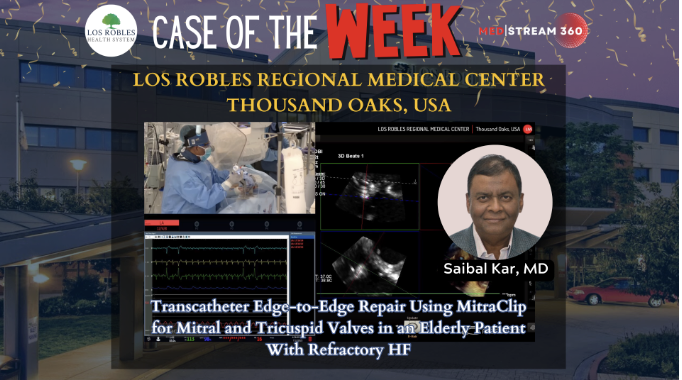 GreggWStone's tweet photo. Medstream 360 case of the week - archived and worth watching! @MedStream360 https://t.co/SdMnIMZWmm