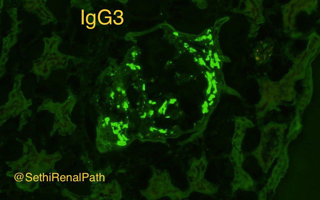 Sanjeev Sethi tweet media