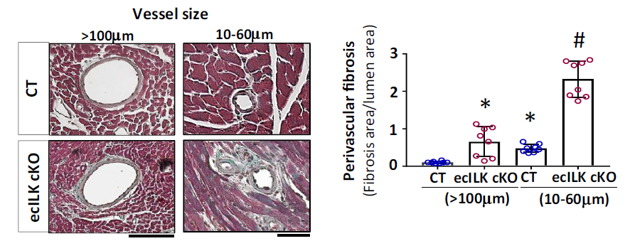 BasicResCardiol's tweet photo. Endothelial integrin-like kinase protects coronary microvascular and cardiac contractile function.
https://t.co/mKtJmM9645 https://t.co/gA53WQThRd