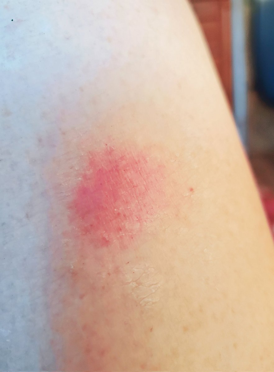 Nana The Bird Lady on Twitter: "I was steam cleaning bird cages and the