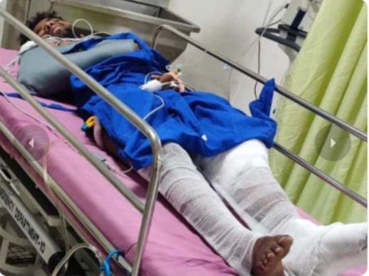 VDTrendsOffl's tweet photo. A btech student of sv university, Met with a major accident  near kalahasti while returning from Sriharihota after witnessing successful launch of great Indian mission chandrayan -3.
Severe injuries and fractures, admitted in CMC Ranipet emergency 

- https://t.co/u19u6DqsdR https://t.co/UvWBKqKwvX