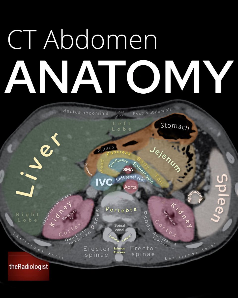 pgMedicine's tweet photo. CT Abdomen Anatomy 
@radiologistpage https://t.co/JJqTScLWoz