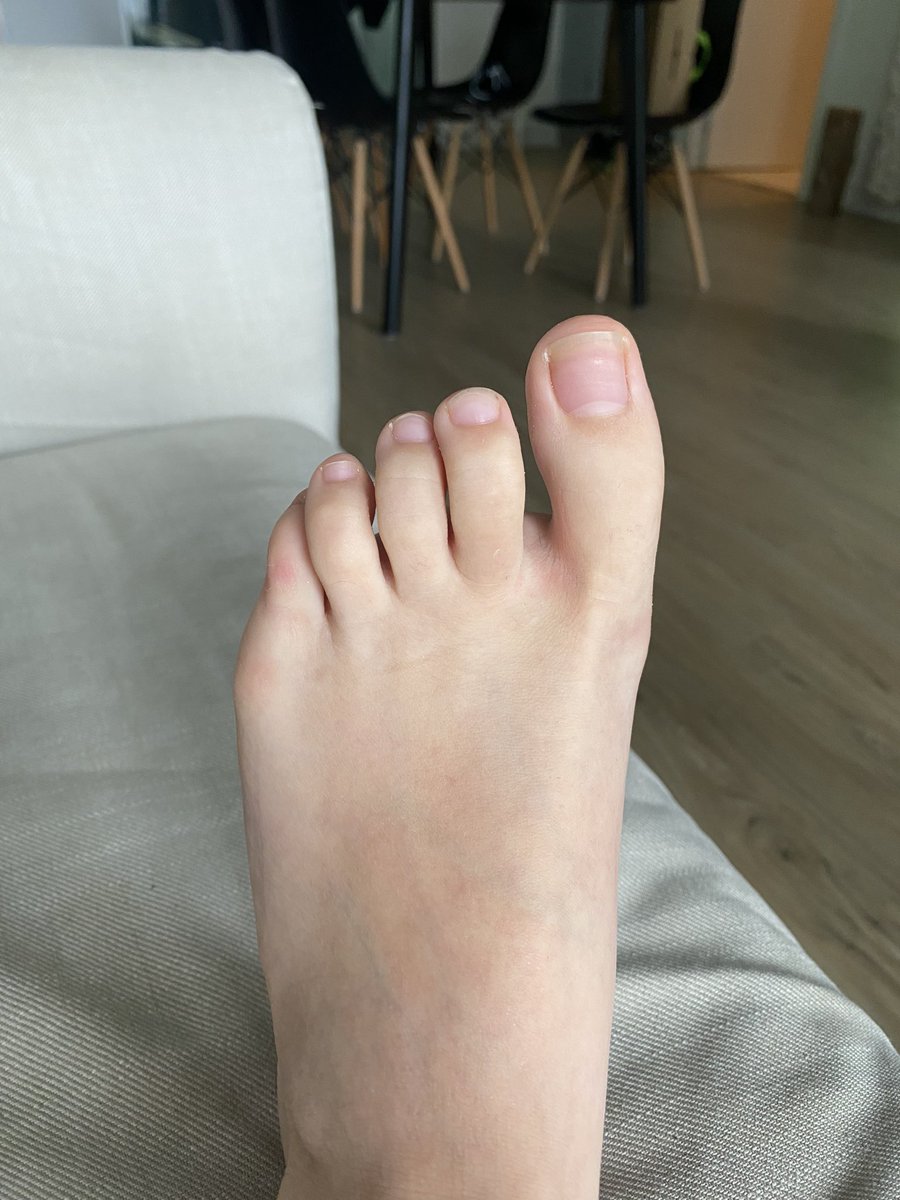 LadyToes10's tweet photo. Here to satisfy you https://t.co/JBu4oR7WrZ

I take requests 😘 
#feet_lover #feet_pic #toes #feetcontent #feetpicsforsales #feetseller #foot #toe https://t.co/FidOdzYaKk