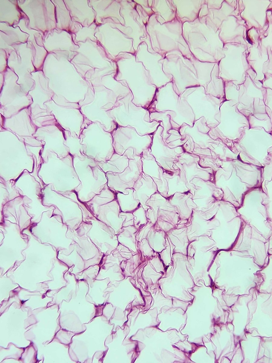olkazuraw's tweet photo. Captured adipose tissue using my phone &amp; @skopedmicro adapter! 

Thinking of hosting a webinar on microscopic photography. 

Interested? 

Comment below - if we hit 15, it's happening! 📲🔬 

#MicroscopicPhotography #PathArt #DigitalPathology https://t.co/pP3bnSyd62