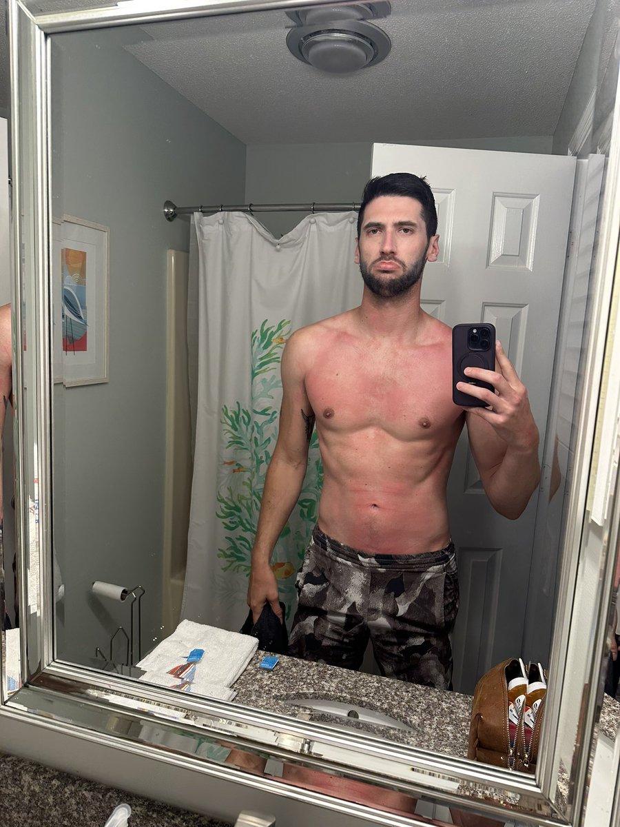 Let’s see those sunburns, fellas 🥵