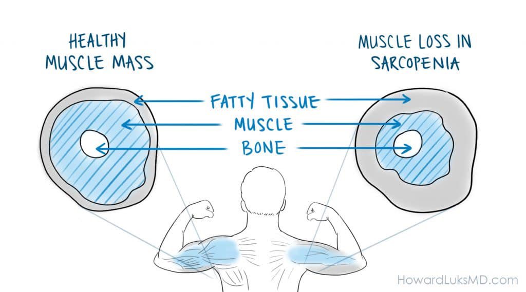CristiMarcucci's tweet photo. Muscle is the organ of vitality and longevity! 💪🏼
 
It plays a vital role in hormone metabolism, overall health and ANTI AGING 😊. 

This is 53 💪🏼

#muscle #workout #iworkout #liftheavy #nutrition #diet #protein #elderly #gettingolder #antiage #younger #livingto100 #menopause https://t.co/X6bMRW6CB8