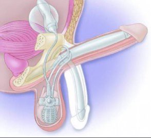 HerbalistChief's tweet photo. SOLUTION TO ERECTILE DYSFUNCTION

Chew the root of Sida acuta (twita)
intermittently throughout the day.
It makes the dick stronger and helps men to keep firm erection. It’s also good for men with low sperm count. https://t.co/nsX58jLSts