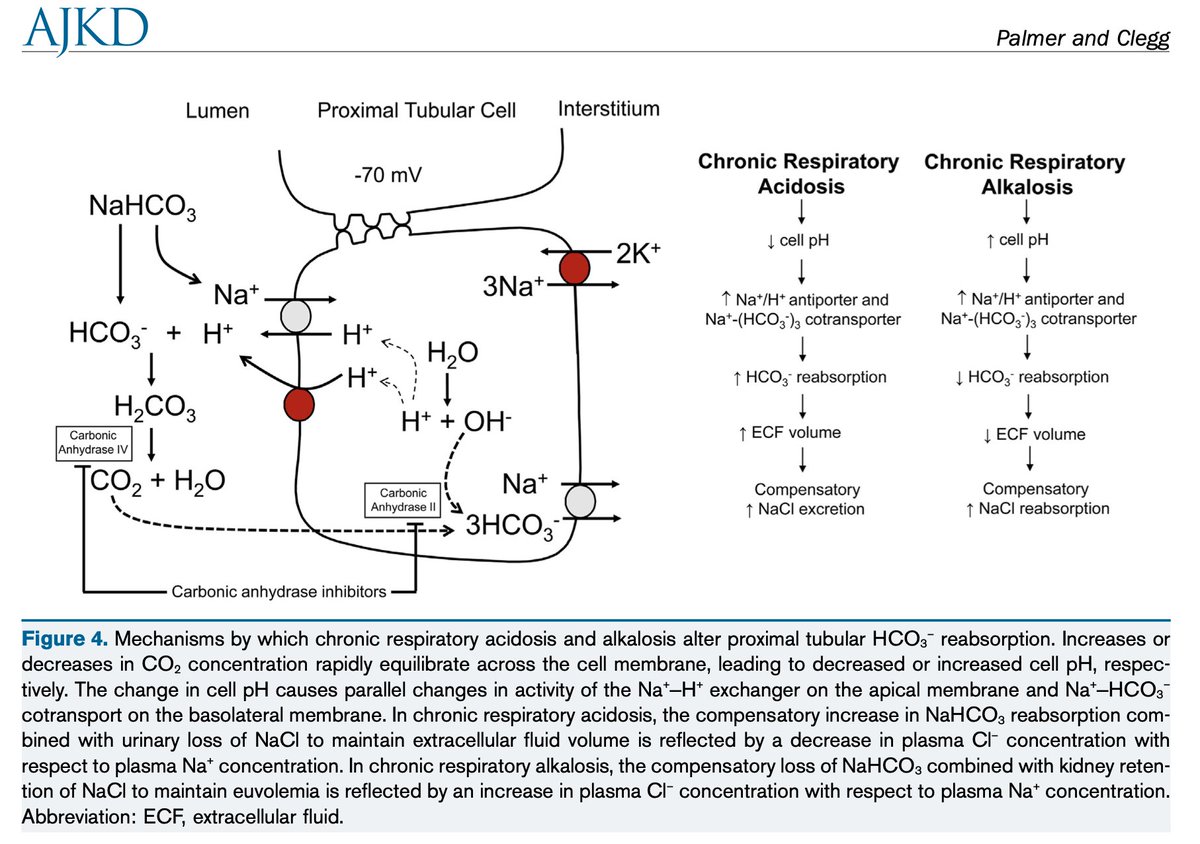 AJKDonline's tweet photo. Core Curriculum by Biff Palmer and Deborah Clegg:

Respiratory Acidosis and Respiratory Alkalosis: 

https://t.co/mlUMp1ZaCB (FREE) https://t.co/NG3Lfu9B2Y