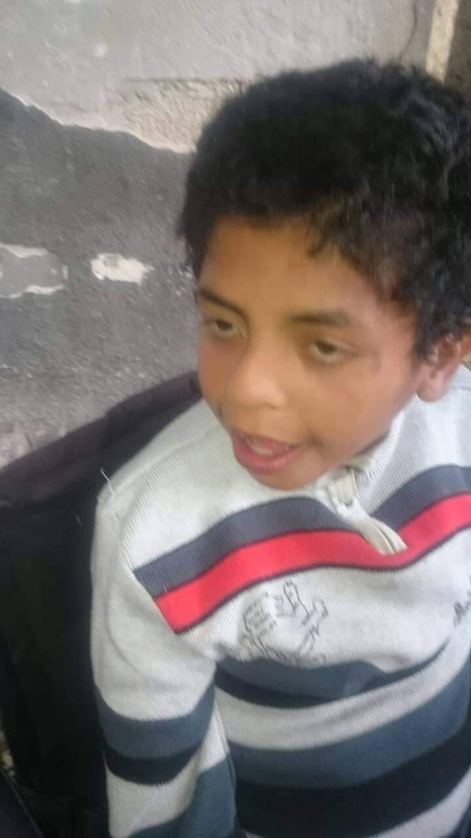 hfg_vcj's tweet photo. https://t.co/MF7cQ38t3H🙏
Greetings to everyone from the State of Palestine, I hope you sympathize with my sick child who needs everyone's help in order to improve his condition and buy treatment for him. https://t.co/VzhnvpfDEo
