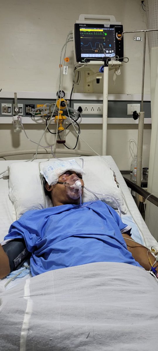 <a href="/vlwjharkhand/">झारखण्ड राज्य जनसेवक संघ</a> <a href="/HemantSorenJMM/">Hemant Soren</a> <a href="/Badal_Patralekh/">BADAL</a> <a href="/jharotef/">NMOPS / JHAROTEF</a> @nisha_singhmarr माननीय मुख्यमंत्री <a href="/JharkhandCMO/">Office of Chief Minister, Jharkhand</a> जी से अनुरोध है कि मामला का संज्ञान लेने की कृपा किया जाए और आर्थिक रूप से कमजोर और गंभीर रूप से घायल जनसेवक #UDAY,जो Trust Hospital, Ranchi में इलाजरत हैं को उचित चिकित्सा सुविधा उपलब्ध करवाने की दिशा में त्वरित पहल किया जाए।

सादर  अनुरोध  🙏🙏