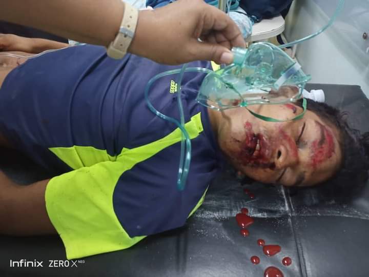 eduardprietor's tweet photo. #Atención este joven fue  atropellado San Félix edo Bolívar  y está en el Hospital de Guiparo. No hay nadie con el, si alguien lo conoce avise a sus familiares. Rt https://t.co/nPGyaEJ4Ce