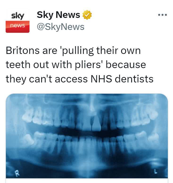 جدی هرچی این خبر رو میخونم باورم نمیشه!!! یعنی چه که تو انگلیس دندونشون رو با انبر میکشن چون به دندون پزشک دسترسی ندارن؟!!