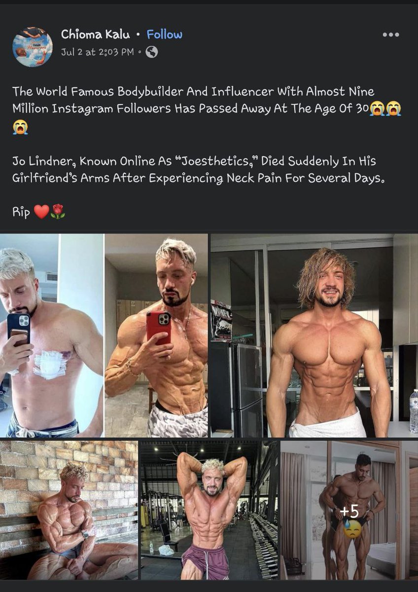 Joesthetics was vaxxed and faced many health issues because of it. 💔
