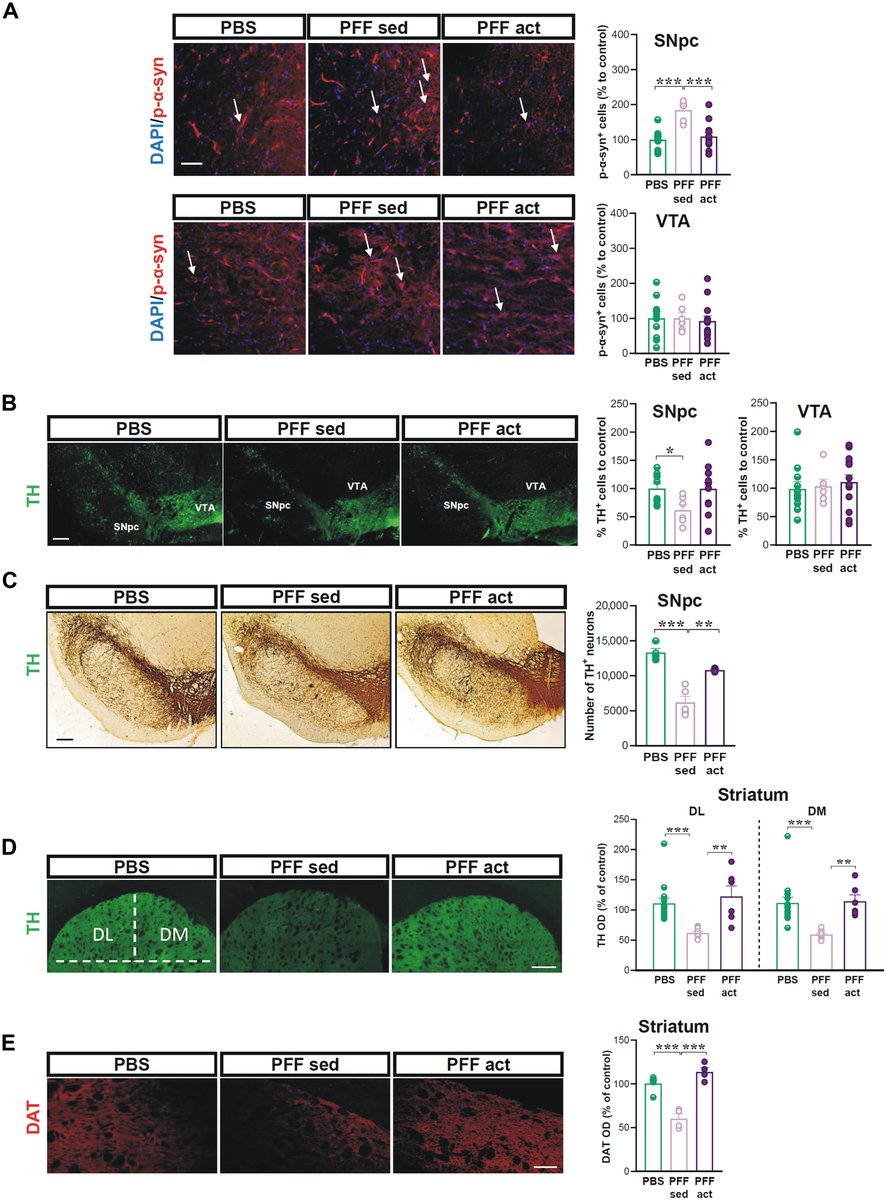ScienceofPD's tweet photo. Exercise &amp; #Parkinsons: Researchers tested the hypothesis that intensive treadmill training can rescue alterations in striatal plasticity &amp; early motor/cognitive deficits in rodents receiving an intrastriatal injection of alpha-syn preformed fibrils
https://t.co/ueJOsotF25 https://t.co/JPTHN8eyXv