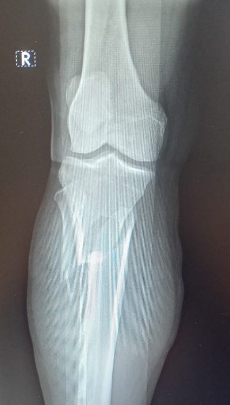 Dr Balamurugan J 🇮🇳 tweet media