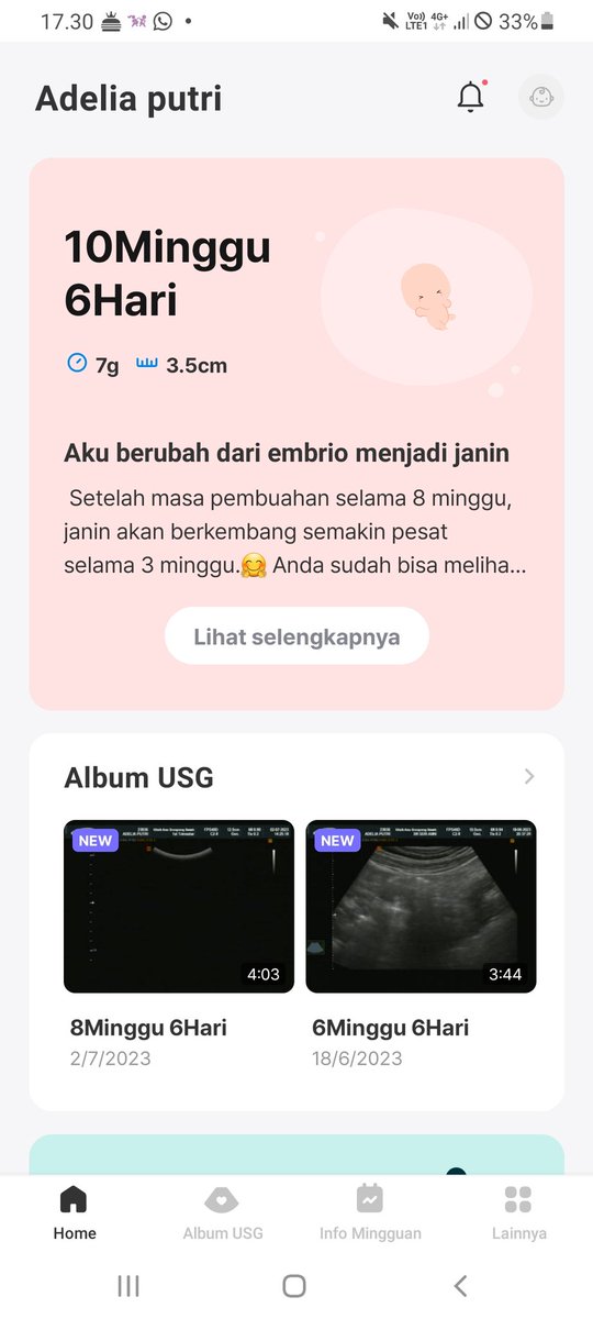 adelia_putrx's tweet photo. Akhirnya beraniin diri buat coba tp masyaallah bener" kaget bngt bener garis 2😭😭 seneng bngt akhirnya yang aku dan pak cuamii nanti", alhamdulillah bngt huhu sehat" yaaah dd bayii🥰 kita berjuang bareng" 😇🤲 https://t.co/5yNdkh2ppX