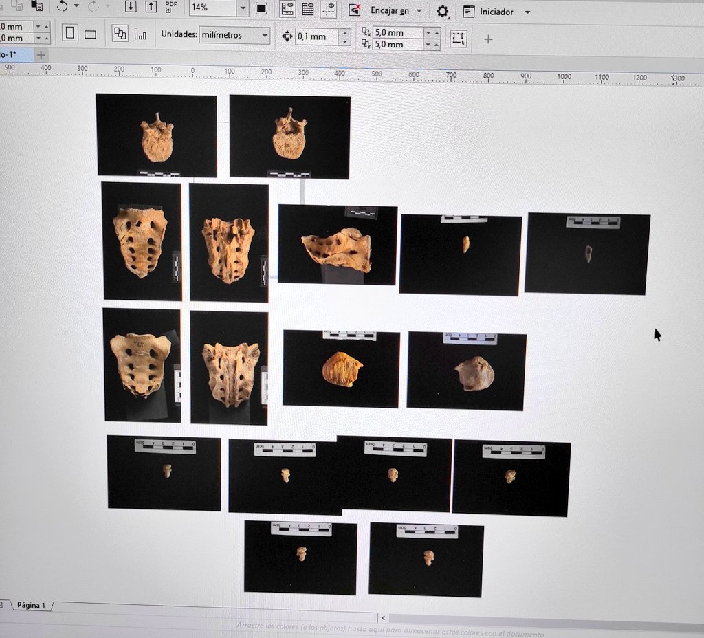 Miguel_preh's tweet image. How it started, and how it ended! Afternoon of doing figures for thesis&apos; Results section 👌🏼💃🏼. These are some congenital anomalies, such as transitional vertebrae, spina bifica occulta, or a case of patella bipartita. #Paleopathology #ForensicTaphonomy #Chalcolithic #RocOrenetes
