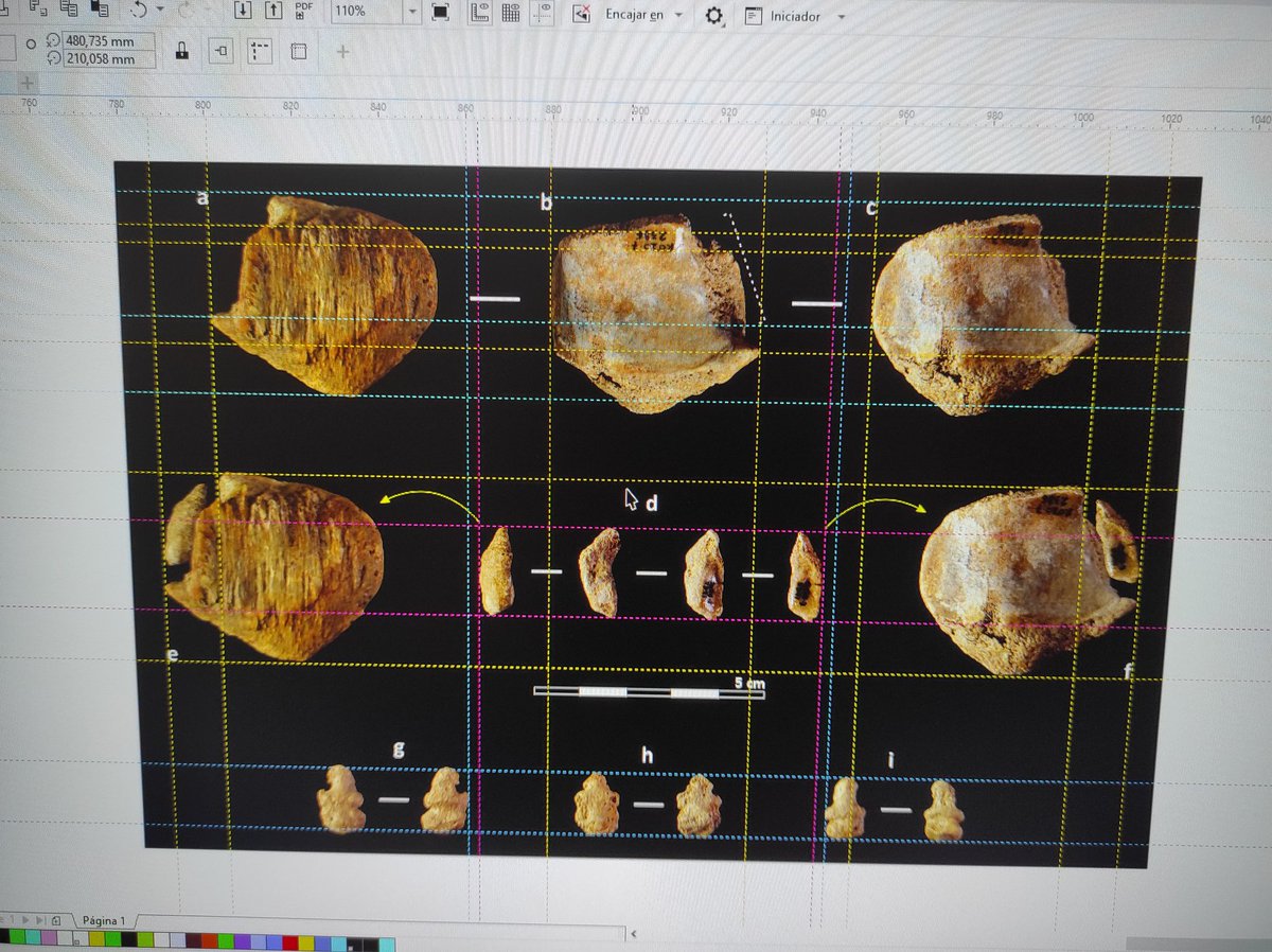 Miguel_preh's tweet image. How it started, and how it ended! Afternoon of doing figures for thesis&apos; Results section 👌🏼💃🏼. These are some congenital anomalies, such as transitional vertebrae, spina bifica occulta, or a case of patella bipartita. #Paleopathology #ForensicTaphonomy #Chalcolithic #RocOrenetes