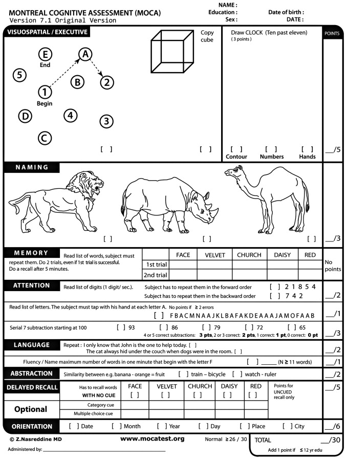 I administered the Montreal Cognitive Assessment (MoCA) to the image-generating AI program DALL-E this morning. Thing really went off the rails. Let's see how it did. 🧵