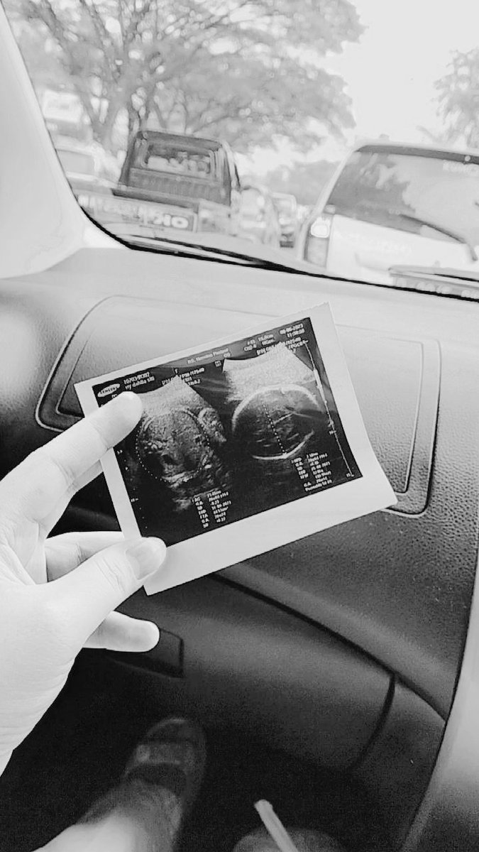 demikimee_'s tweet photo. Hi sayang, kamu tau ga betapa bahagianya aku ketika mengetahui bahwa diriku sedang mengandung seorang anak:) Alasan aku ingin mempunyai punya anak, karena hidupku merasa sepi &amp; sangat tidak berwarna, semoga aja dgn adanya kehadiran sang buah hati, hidupku jadi penuh berwarna💫 https://t.co/GTDTt5X0aQ