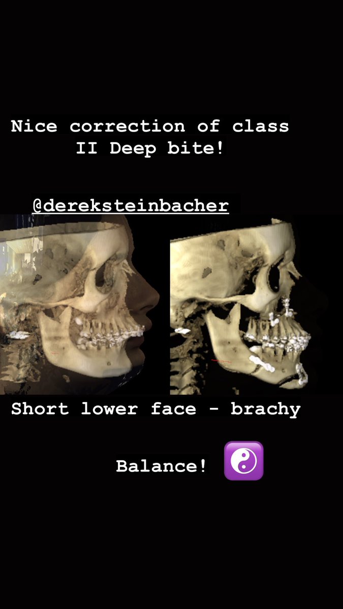 Derek Steinbacher tweet media