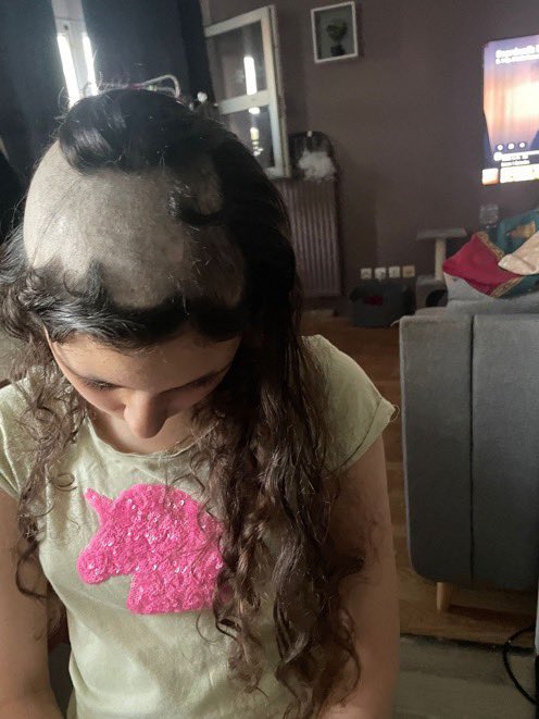 CerfiaFR's tweet image. 🇫🇷 FLASH | Camélia, âgée de 12 ans, subit depuis un an du harcèlement scolaire à #HerblaySurSeine. « T'es moche, t'es une p*te, clocharde, …».

Elle est victime d'insultes, de moqueries sur son physique et de violences. Ce harcèlement a entraîné chez elle un état de…