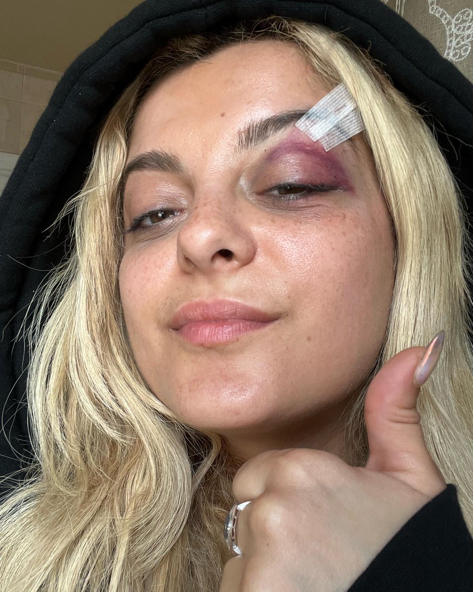 RexhaBrasil's tweet image. Bebe Rexha: Cantora e compositora que virou notícia por ser vítima de agressão física durante show e de gordofobia pelo próprio namorado – Sua história e influência na indústria da música.

Uma thread (RT para chegar a mais pessoas).