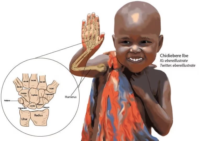 It is indeed concerning to consider whether these #doctors and #healthcareworkers, who have internalized the oppressive system during their own medical education, can effectively serve as mentors. #mandeladay2023 #ABCAC