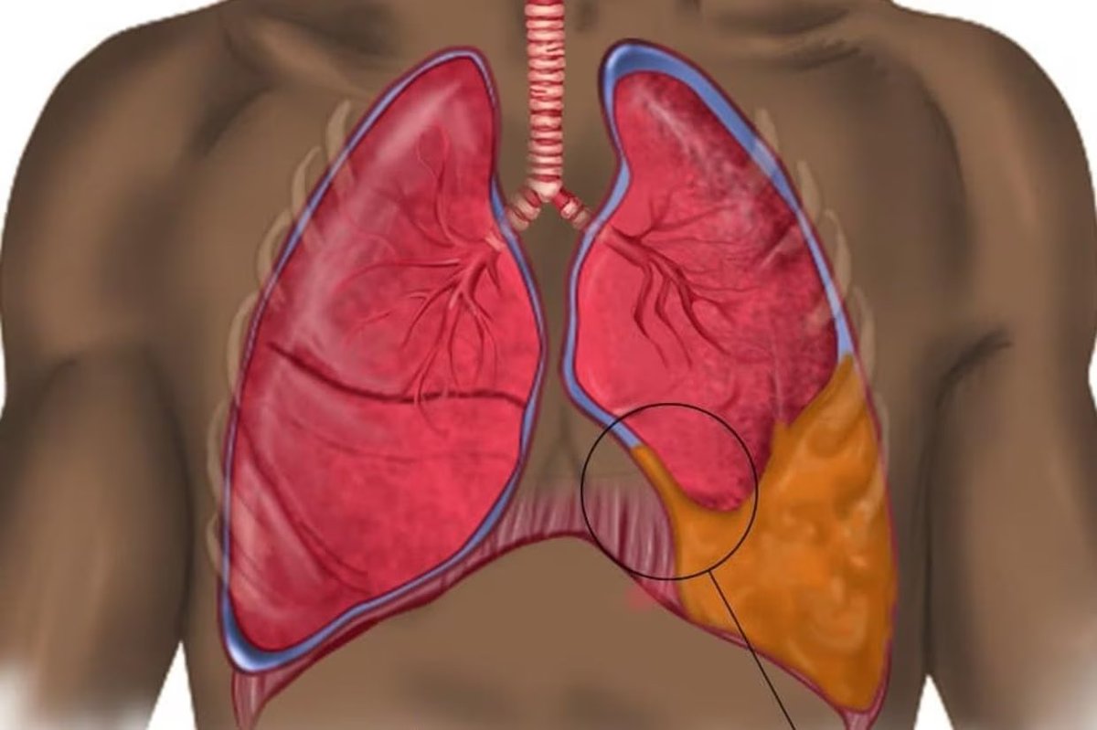 The creation of the images you see would not have been possible within the conventional #healthcaresystem, as senior #blackdoctors have been influenced by a paradigm that normalizes #white images while undermining young black excellence underrepresented communities.