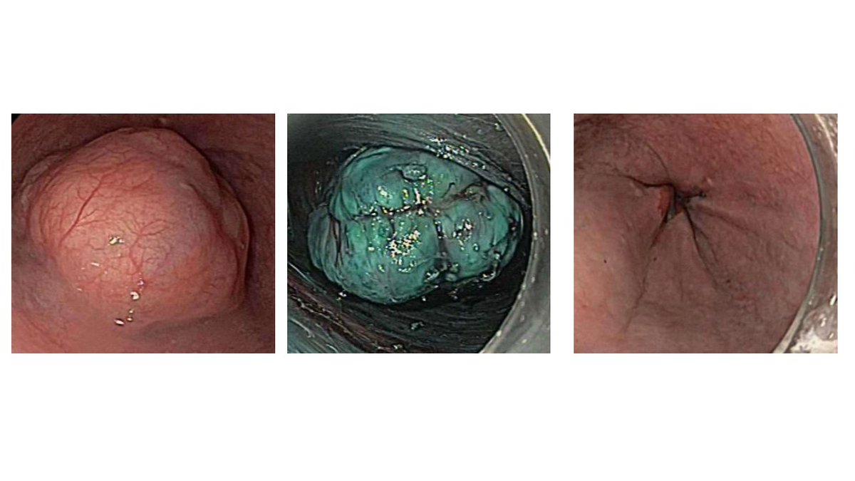 Brisbane Endoscopy tweet media