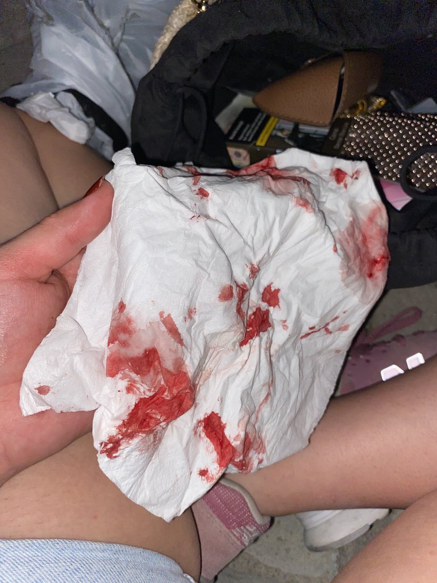 Unutacağımı zannetme,bunun hesabını vereceksin.