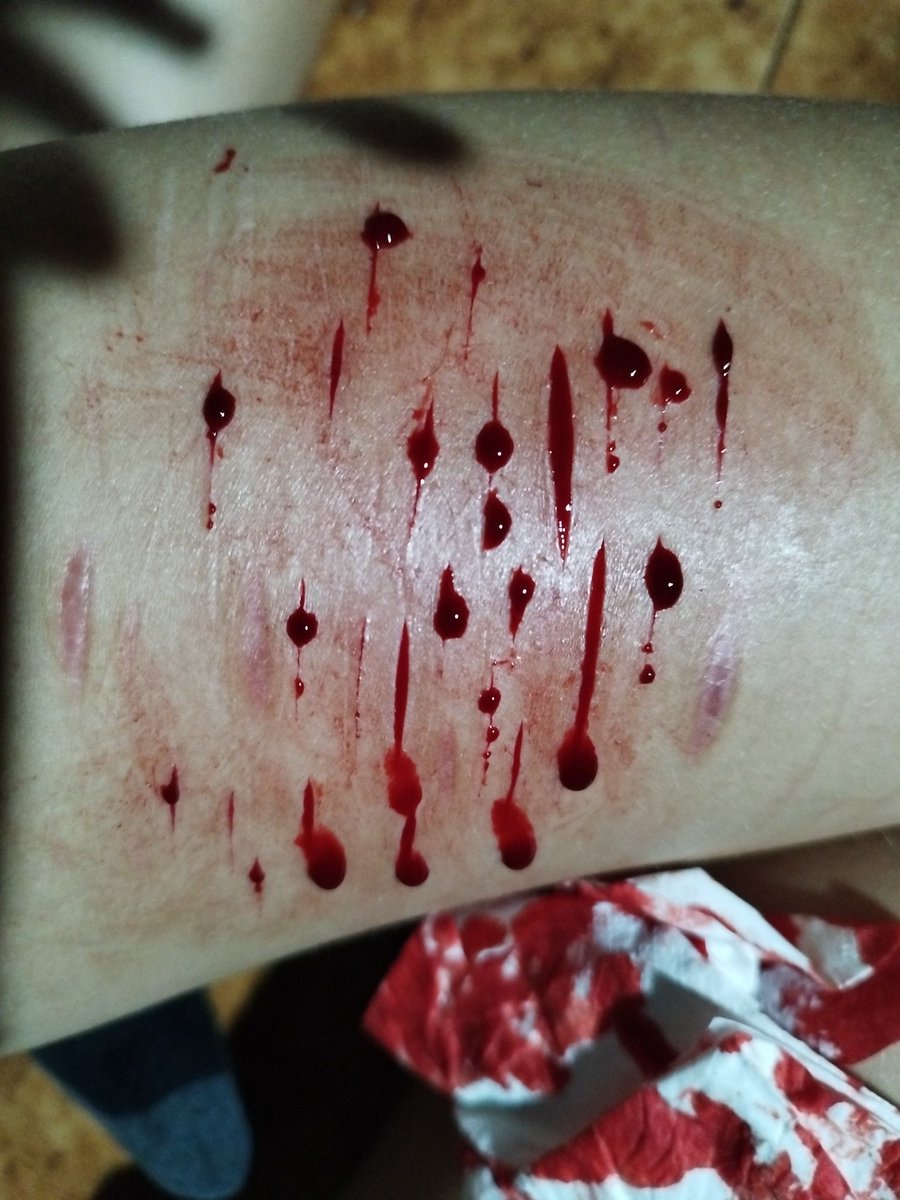 randomventingrk's tweet photo. Oggi giornata lunga e stancante, non volevo relapsare ma eccomi qui https://t.co/MCSGe9OLd2