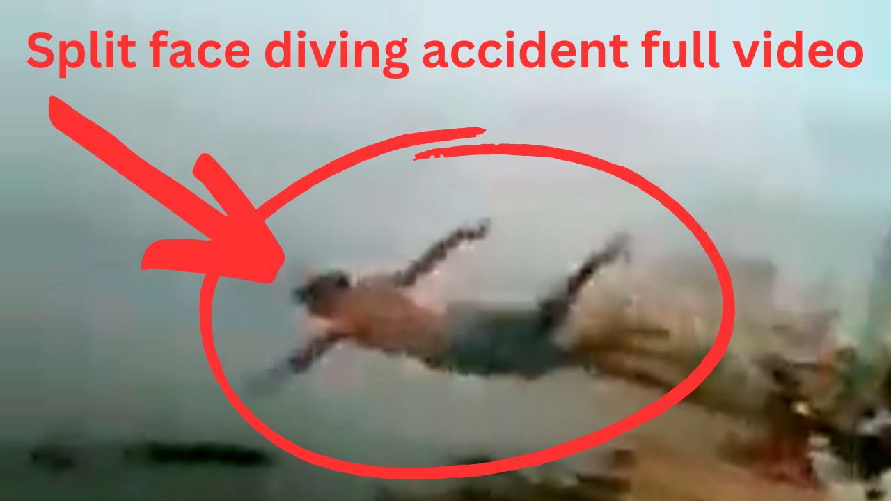 Diving Accident Face Split split face diving accident (@Splitaccident) / X