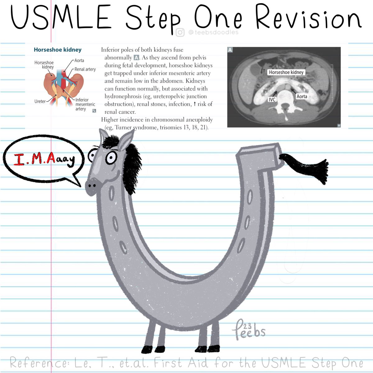 USMLE Step One Revision Doodles #5 Horseshoe Kidney

#usmle #usmlestep #usmlestep1 #usmle_step1 #usmleprep #usmlepreparation #firstaid #firstaidstep1 #doctor #medicine #medical #medicalcartoons #medicalstudent #medschool #medlife #meded #horseshoekidney 

instagram.com/p/Cuy3celA3n2/…